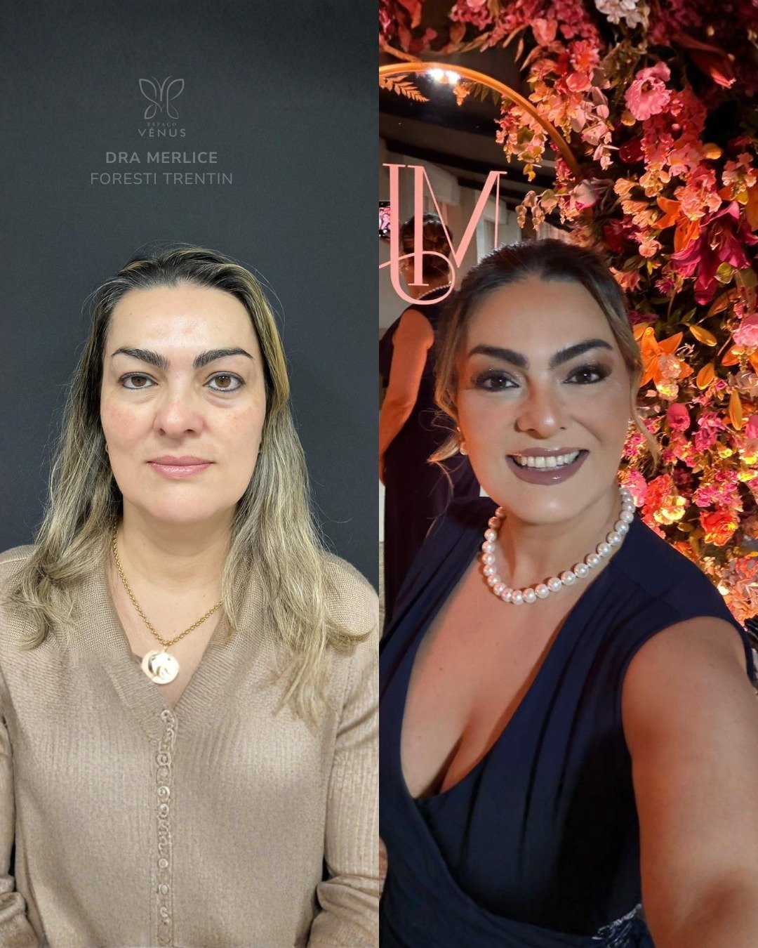 A Pati me procurou com um desejo simples e poderoso- embelezar o rosto e melhorar a qualidade da