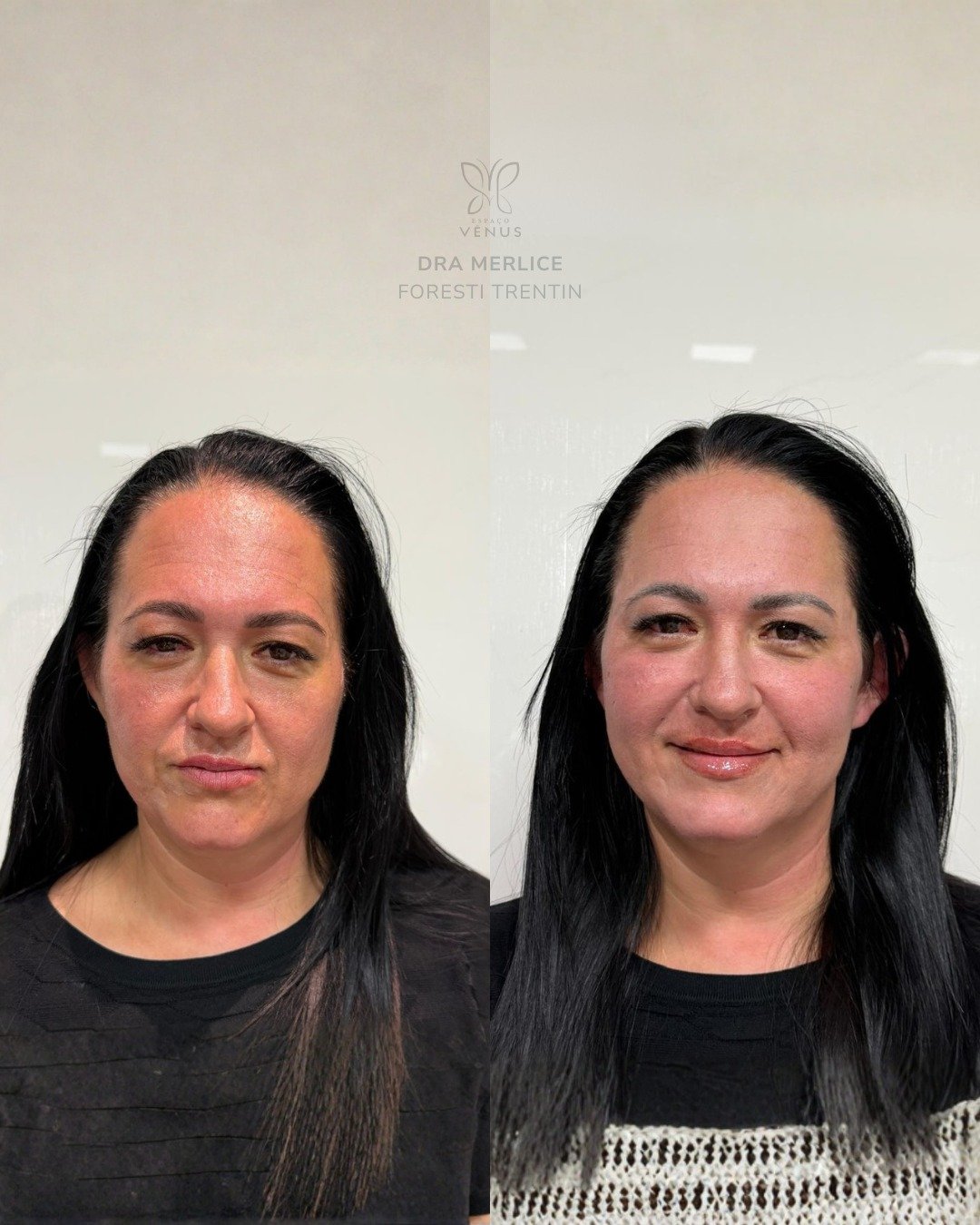 Ela não queria mudar quem era.Só queria se sentir melhor ao se olhar no espelho.Com pequenos toq