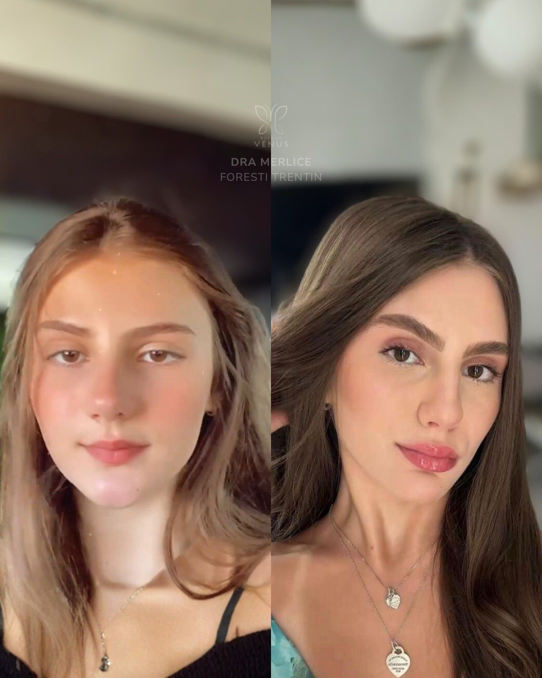 Ela queria um rosto mais marcante, que valorizasse os seus traços.E o objetivo aqui foi justamen