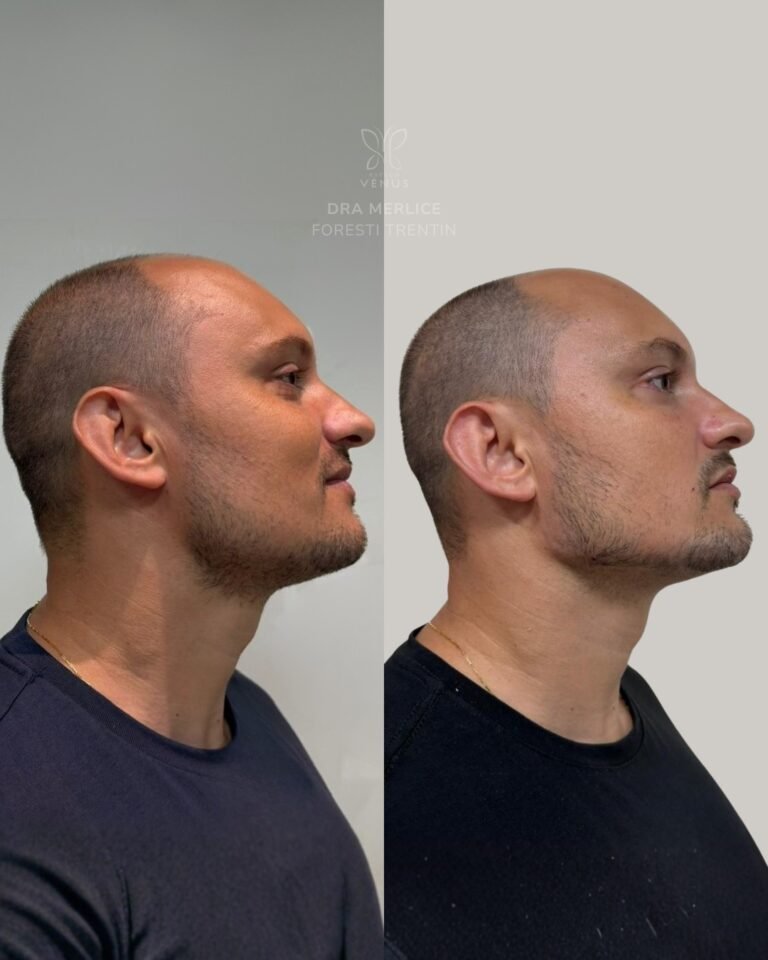 Ele chegou com um desejo muito claro- um rosto mais marcante, mais firme, com presença e, claro (1)