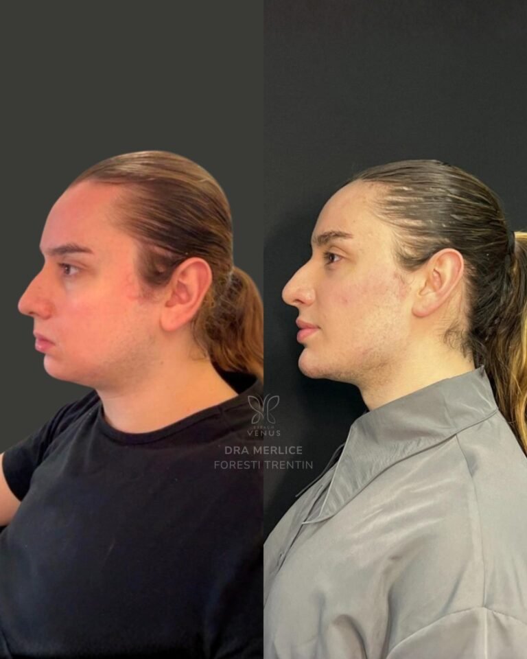 Ele queria que o rosto acompanhasse a força que ele já sentia por dentro.Neste caso, o objetivo