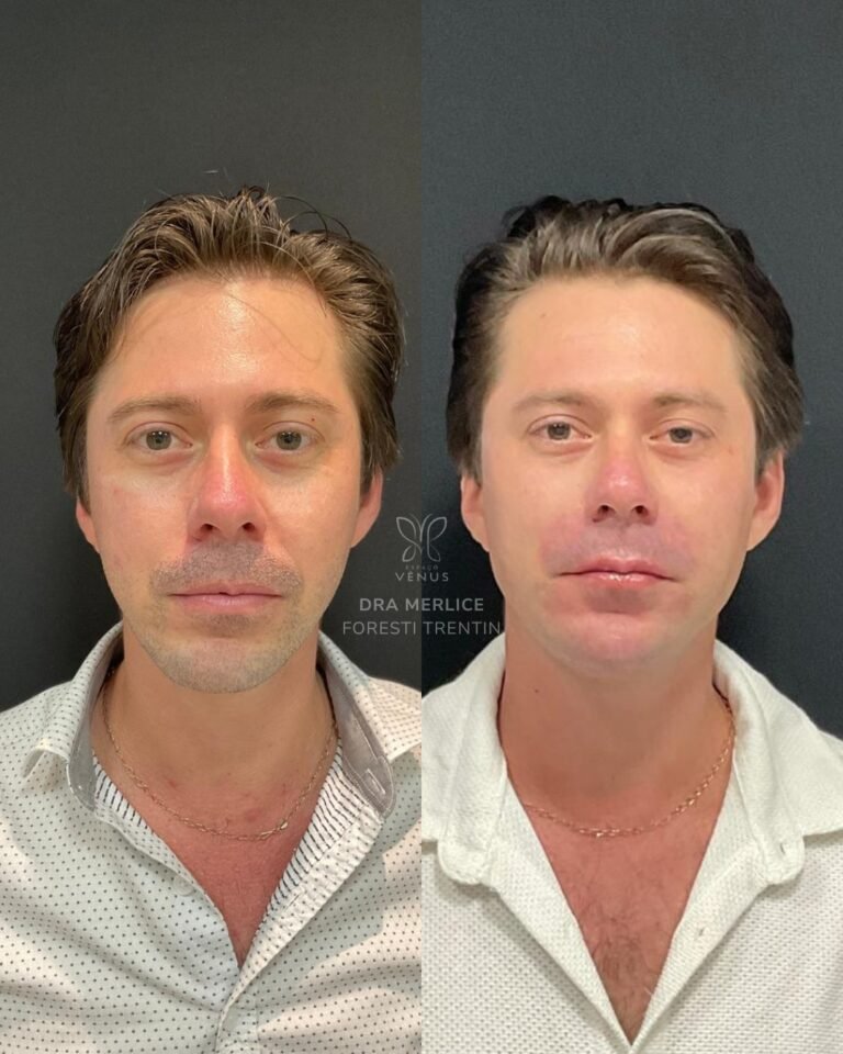 Neste caso, o pedido não era transformação.Era deixar de carregar no rosto um cansaço que não co