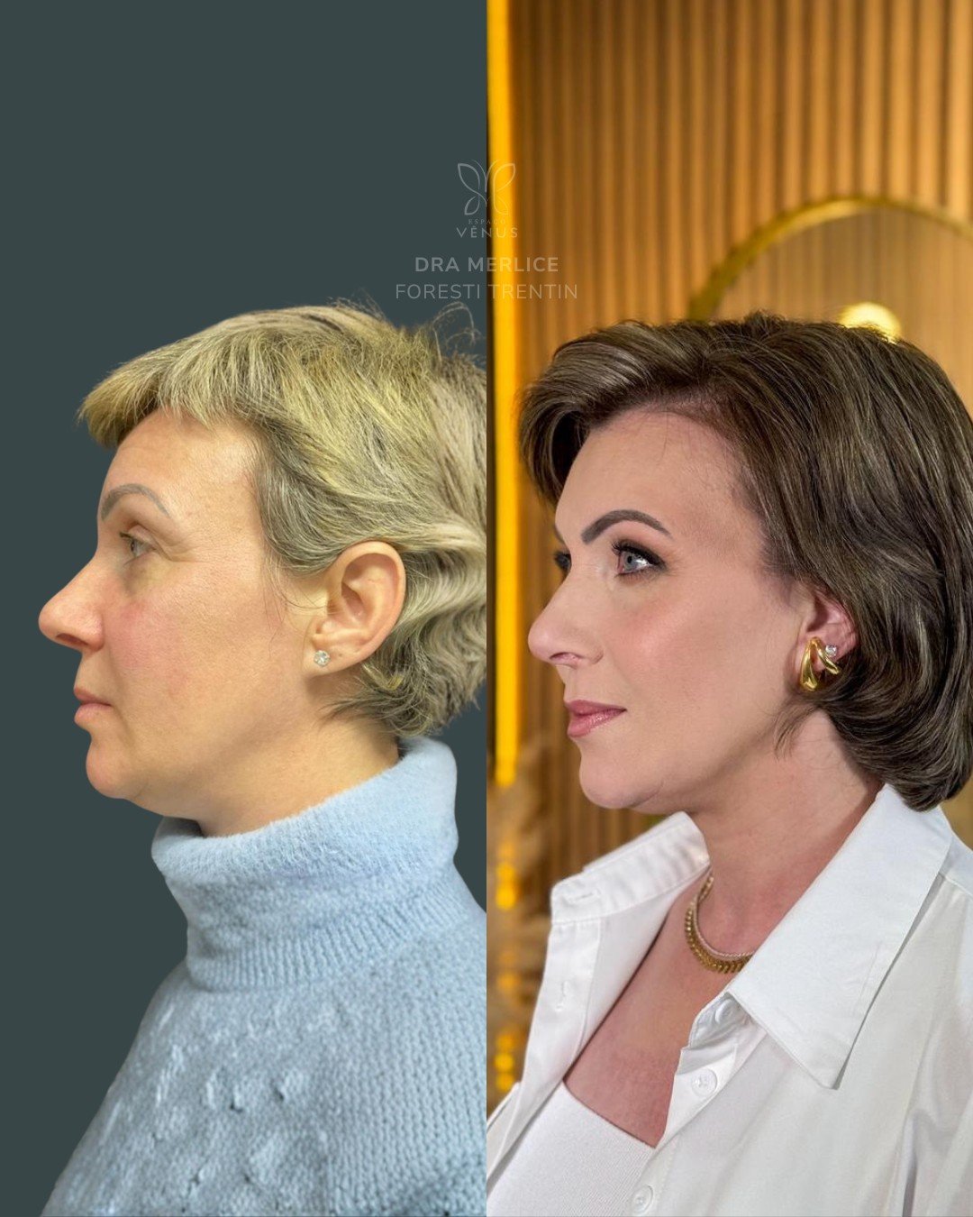 Quando ela chegou até mim, o pedido não era exagerar, transformar ou “virar outra pessoa”. Era v (1)