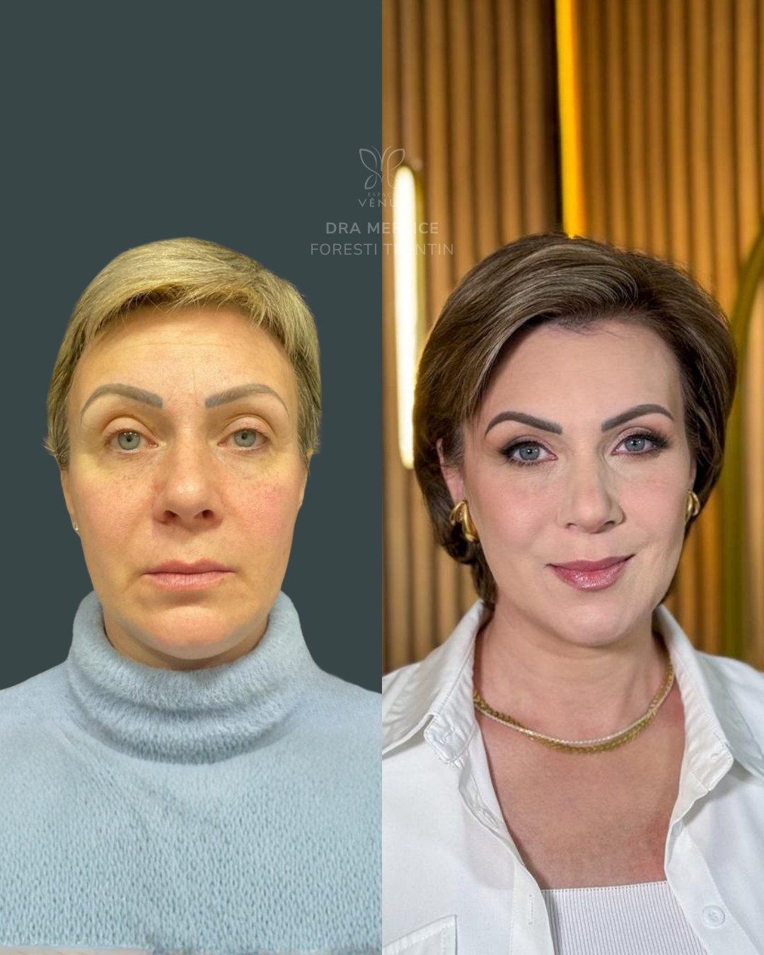 Quando ela chegou até mim, o pedido não era exagerar, transformar ou “virar outra pessoa”. Era v